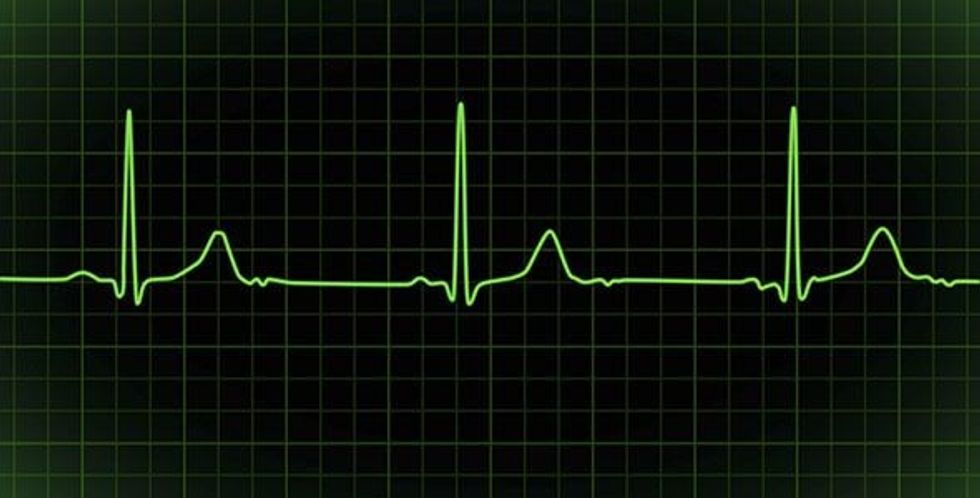 bb8895654bed24b2bea4a9198e914562