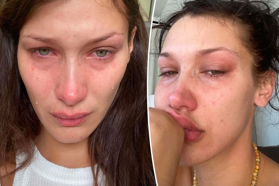 bella hadid depression mental health329 2