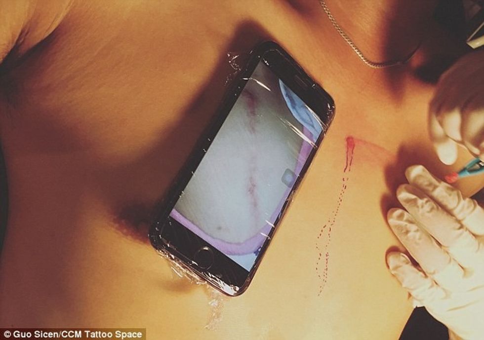 Bëri tatuazh për të mbështetur të birin qe ka nje shenj te shemtuar pas operimit foto 4