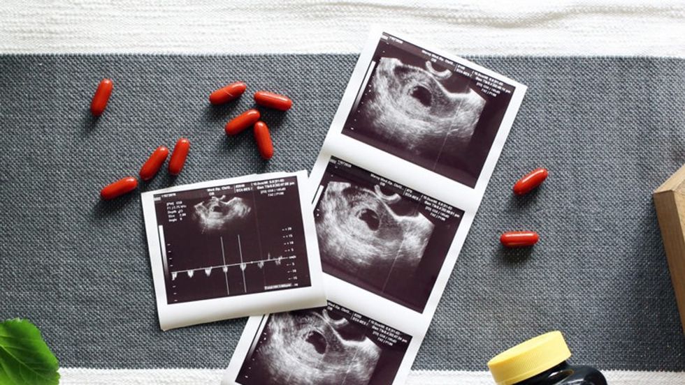 best prenatal vitamins header 1 nvnyk6