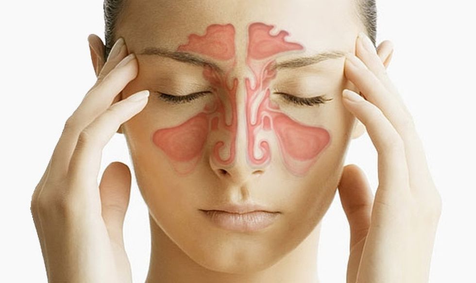 best treatment for sinusitis in bangalore