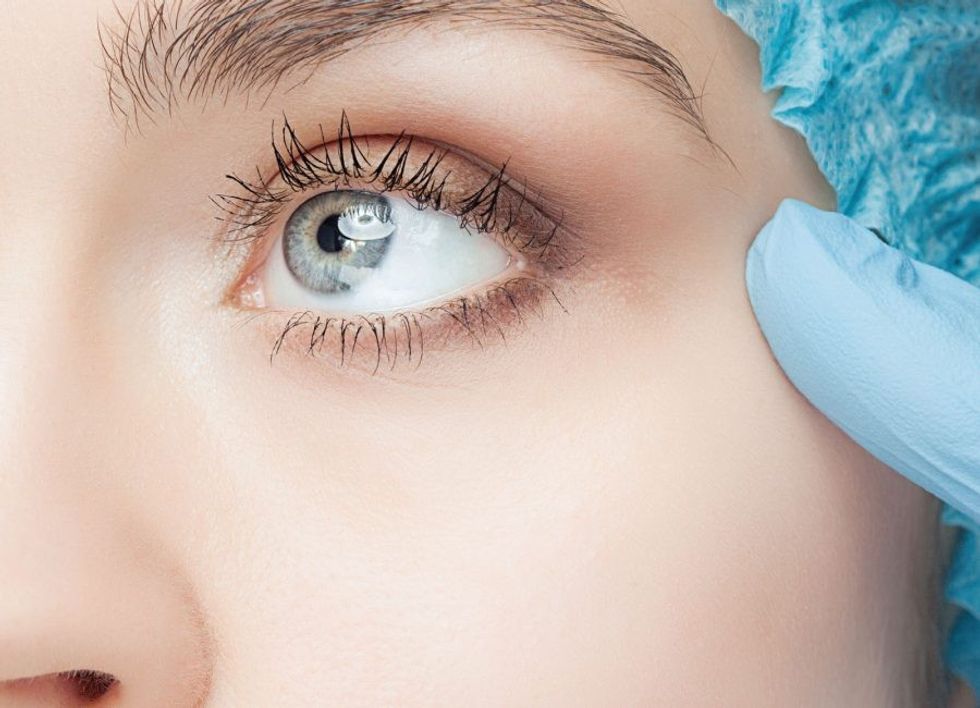 Blefaroplastika slika