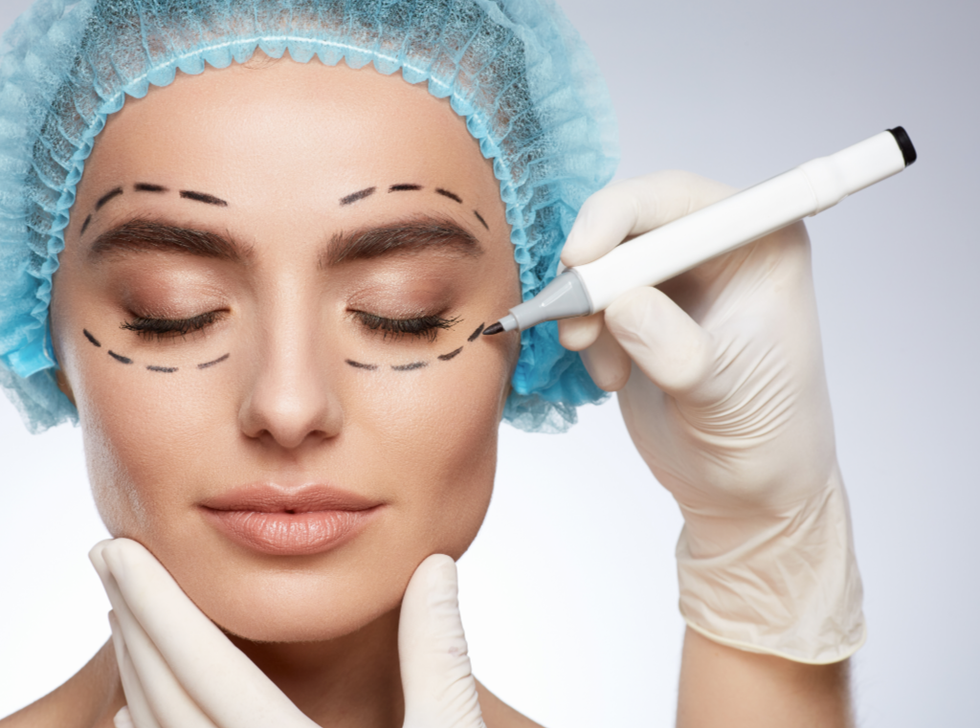 Blepharoplasty