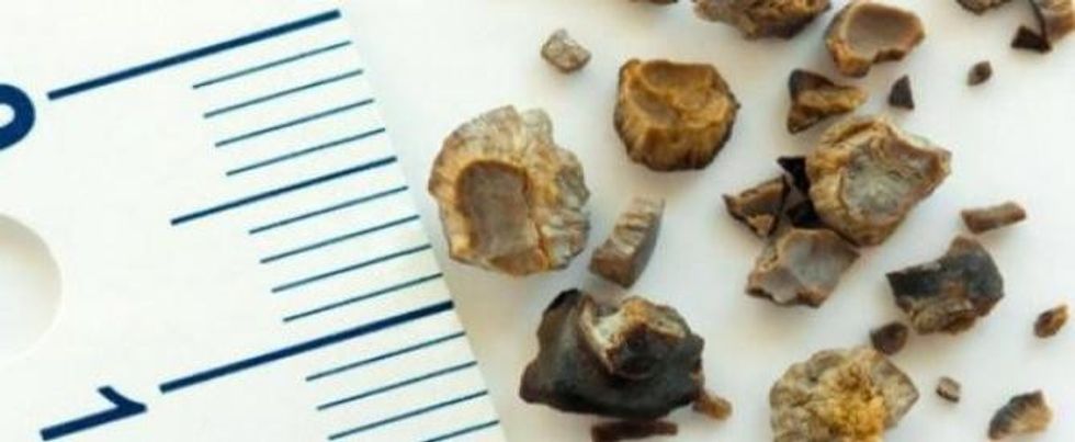 blog 145994754020157291517521a