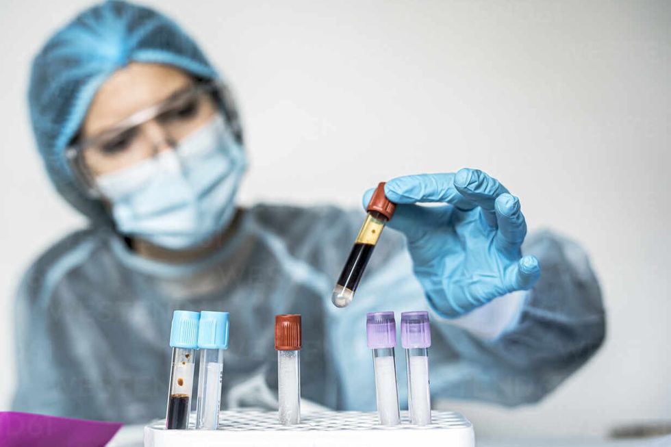 blood test tube with label of covid 19 also known as coron