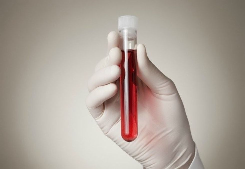 Blood test