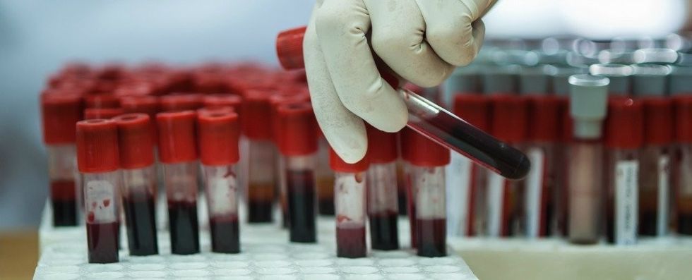 BloodTestHeader 1024