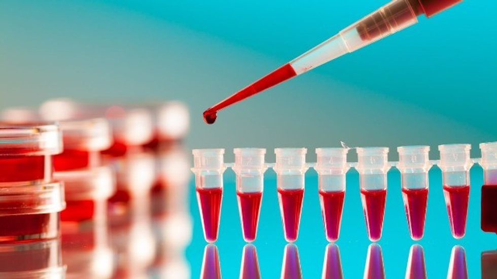 breakthrough new blood test detects positive covid 19 result in 20 minutes 337594