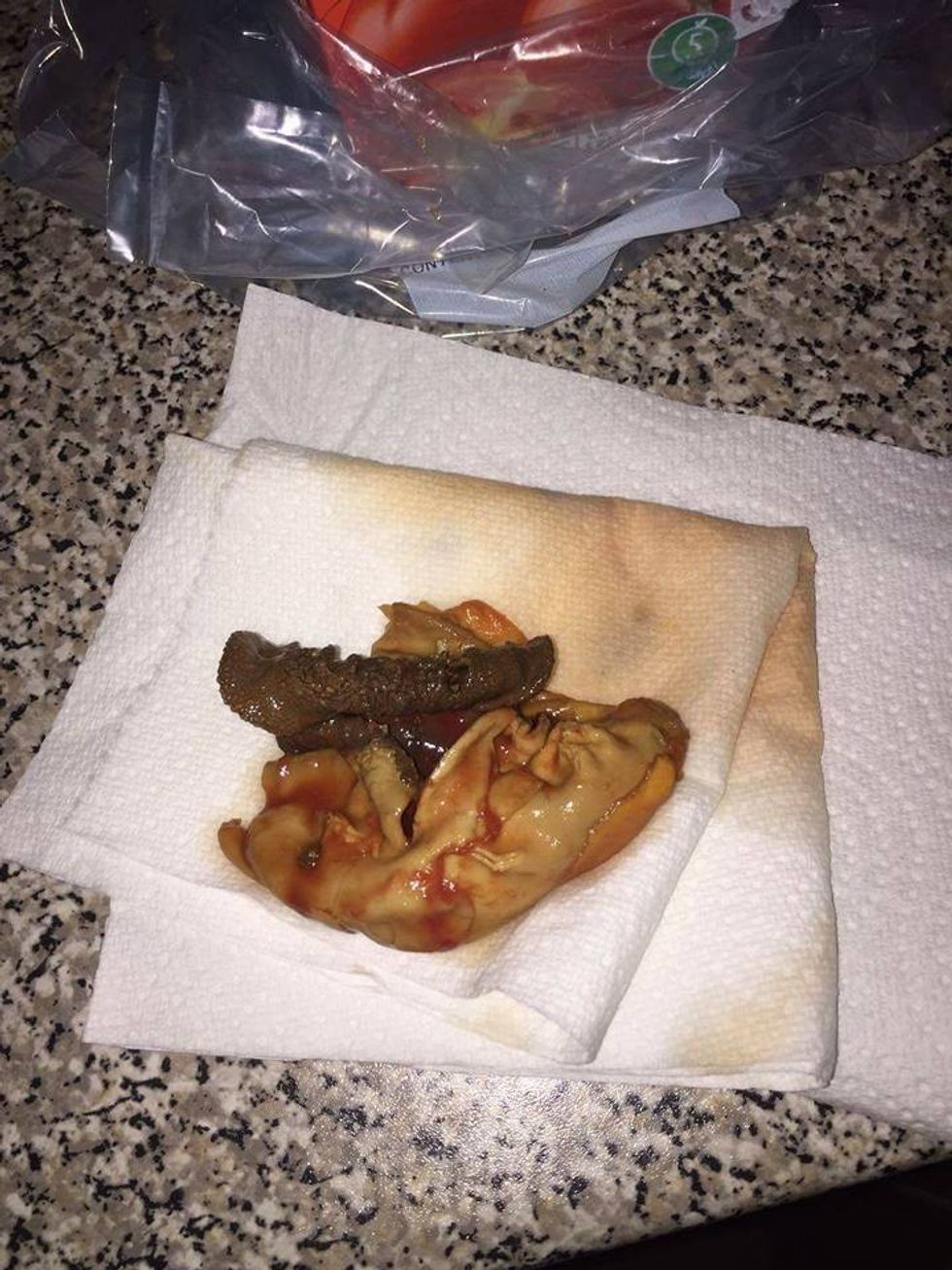 Brenda paketimit të salcës së domateve gjeti objektin bizar qe duket si fetus foto 3