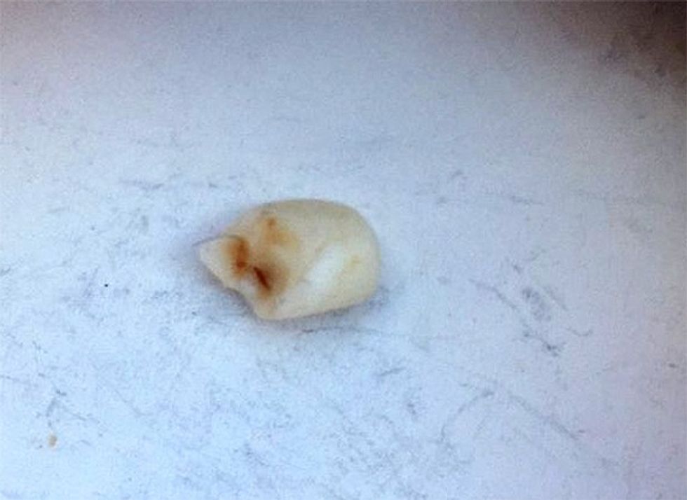 Brenda vezës së çokolatës gjeti një dhëmb fëmijësh foto 2