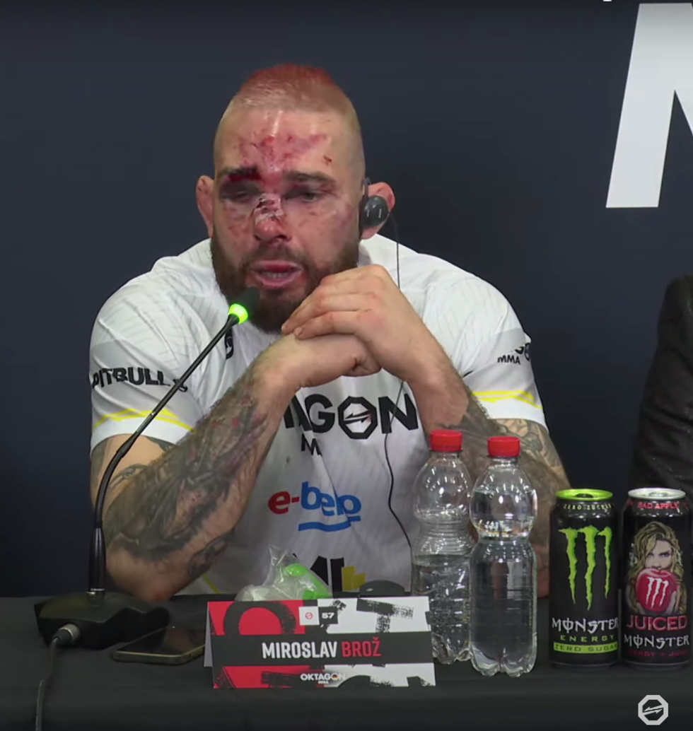 Broz njoftoi tërheqjen e tij në MMA pas humbjes brutale