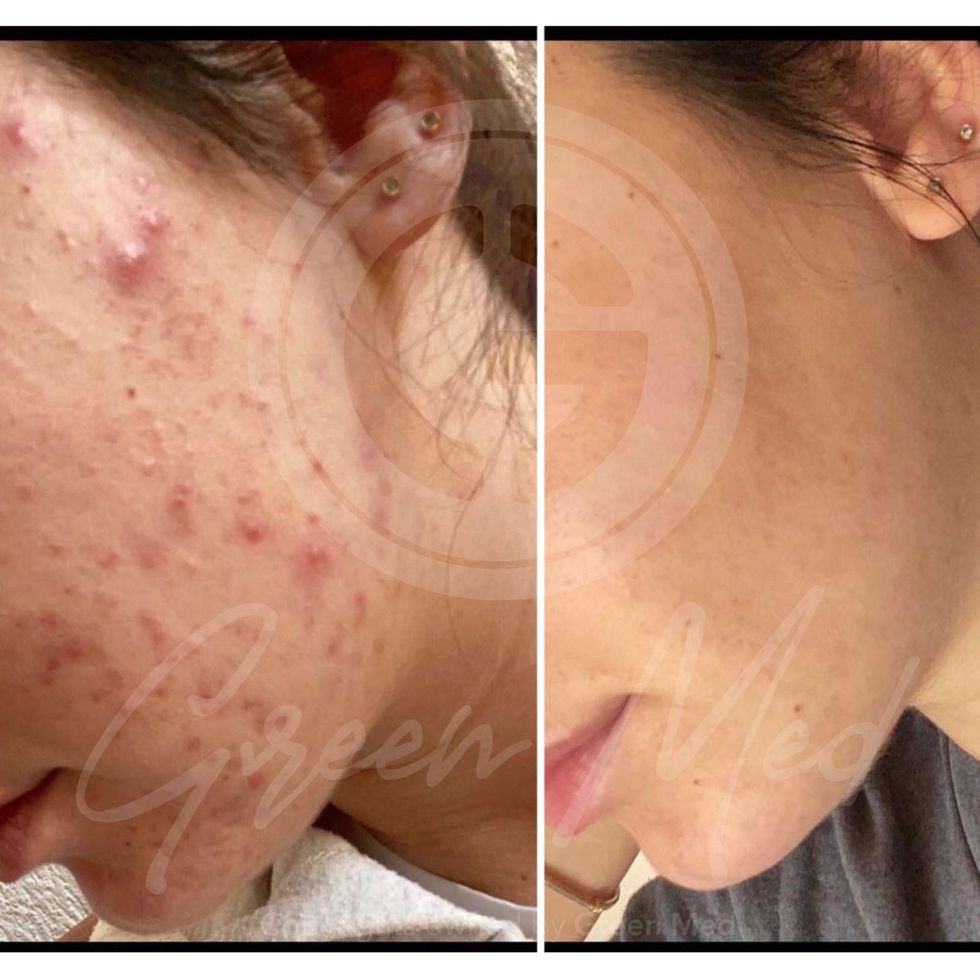 c0088d9b 3571 4358 8566 7abf4976b691