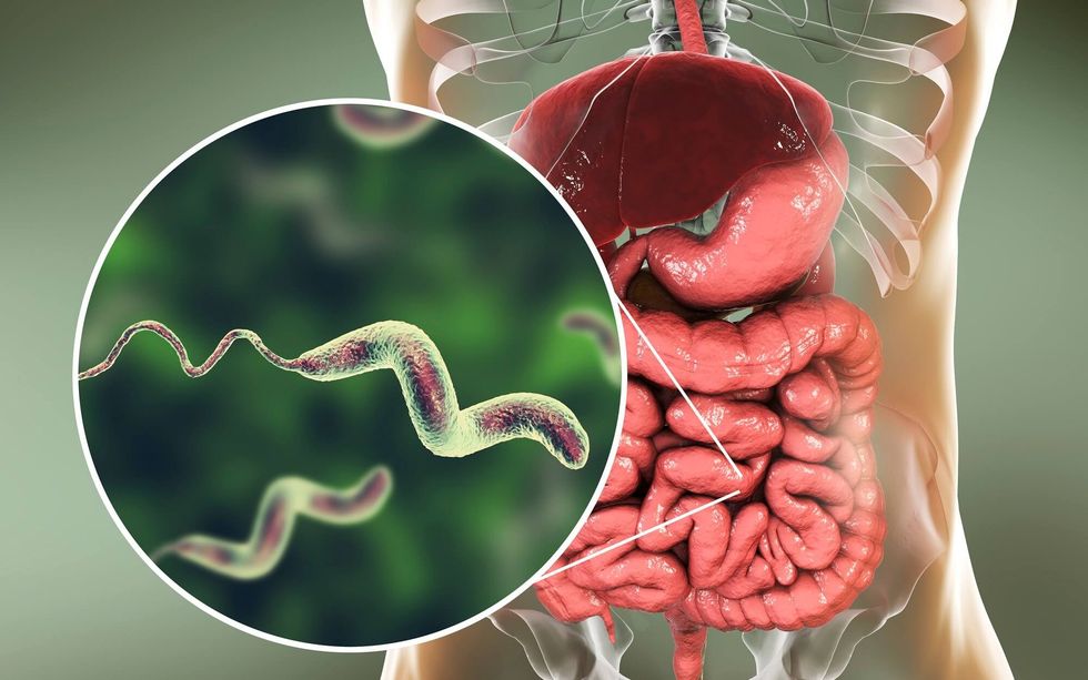 campylobacteriosisg101590040 1504819