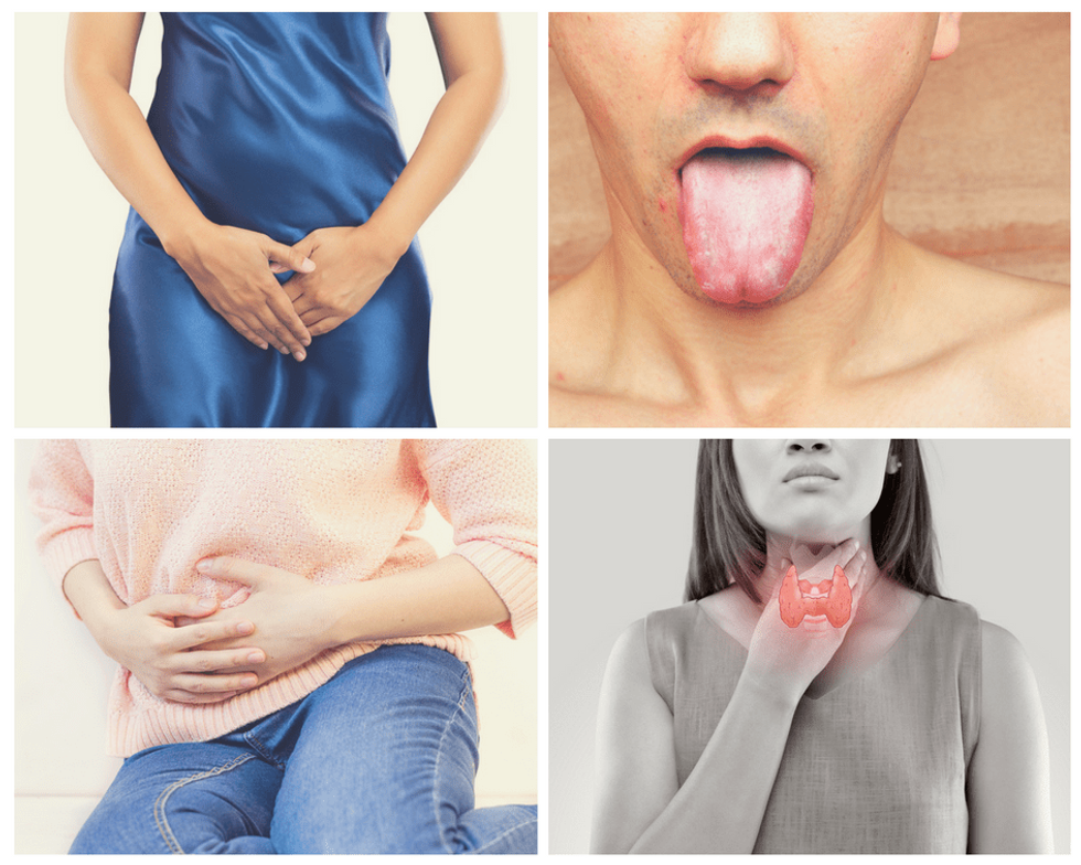 Can candida affect the thyroid cover