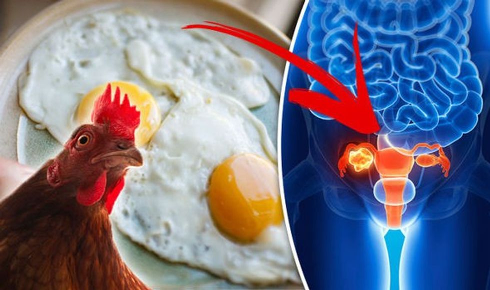 Can eating eggs give you cancer 778727