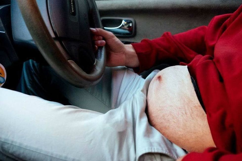 Çanta e çuditshme që ngjanë me barkun e lëshuar foto 2