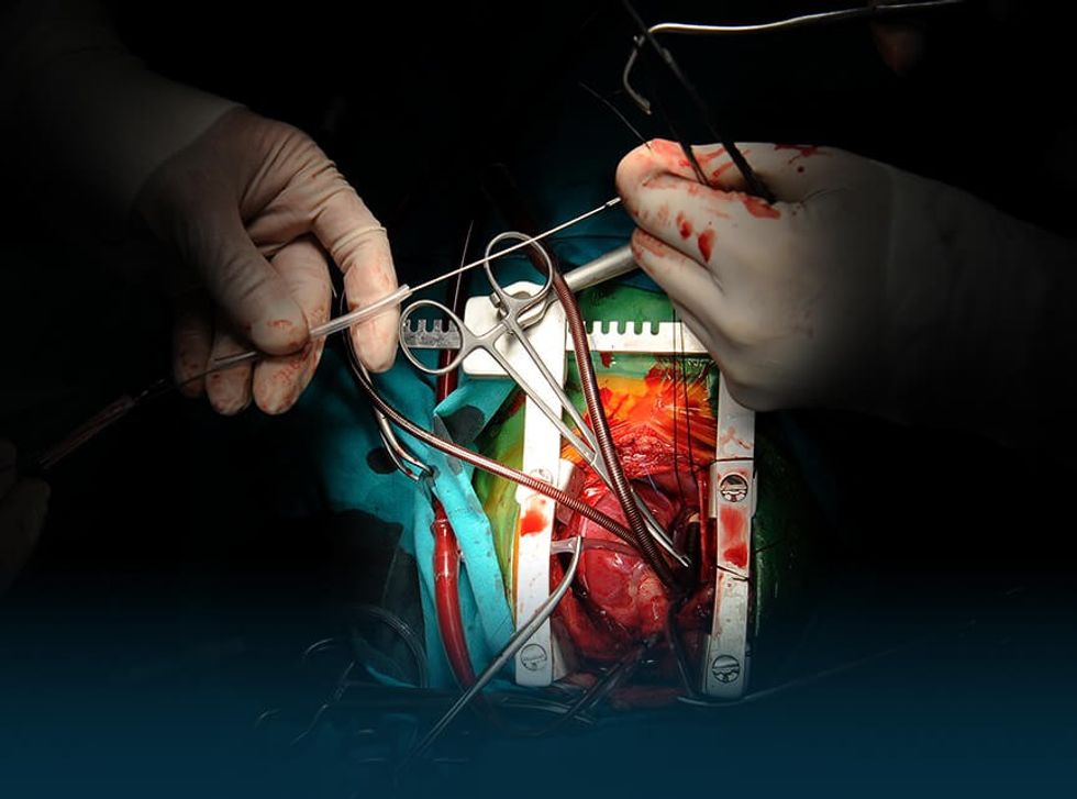 cardiac surgery