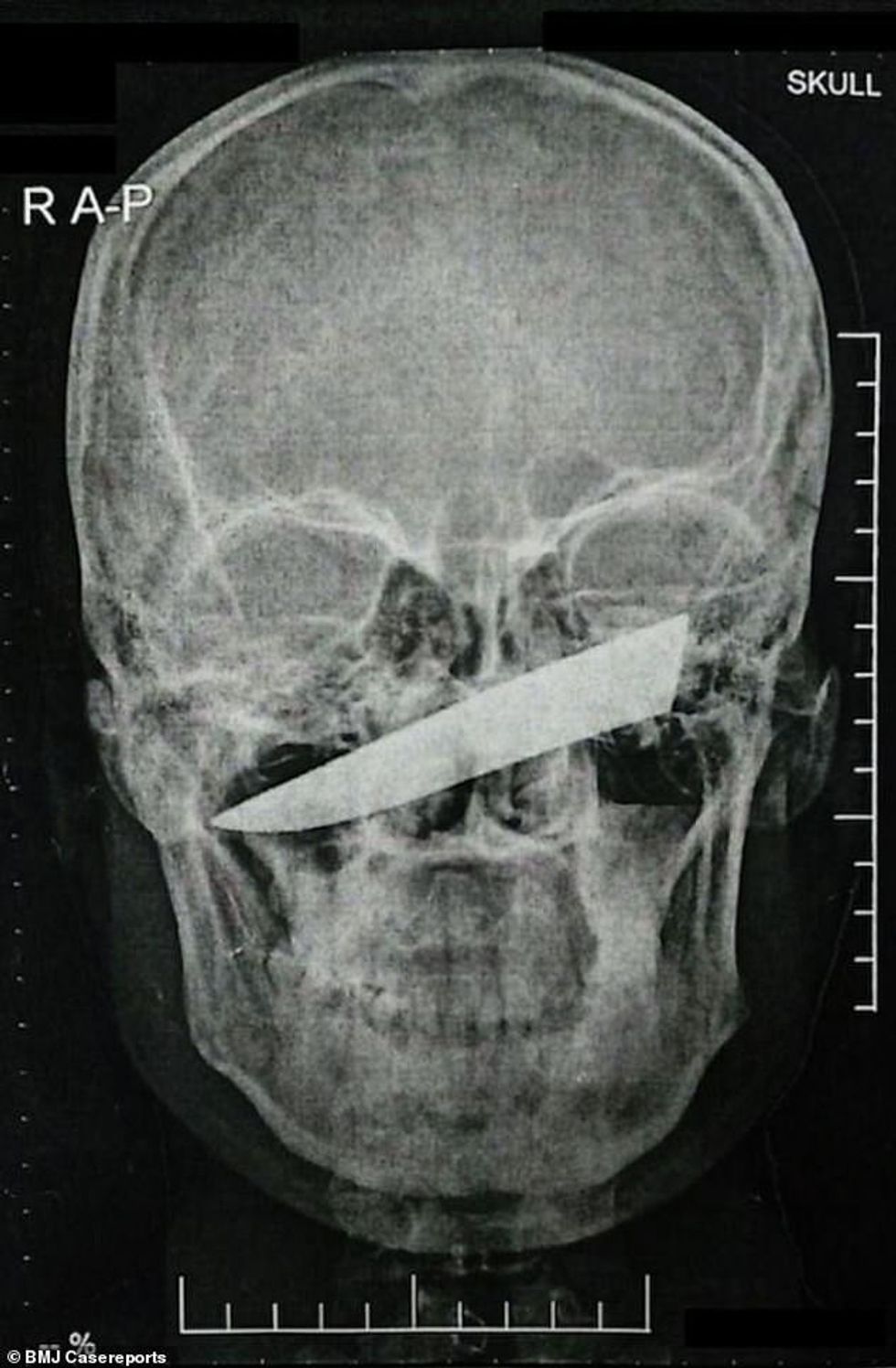 cc5 2