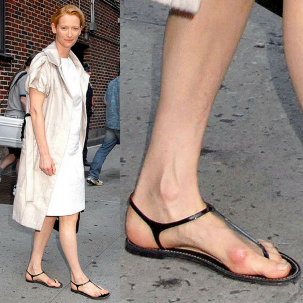 celebrities with bunions amy adams