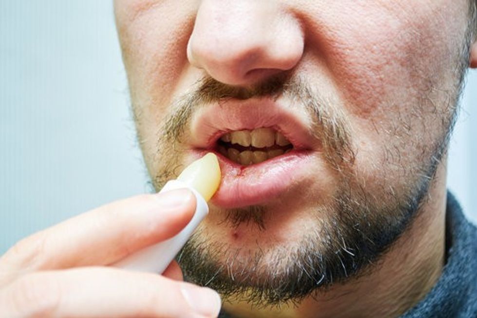 Chapped Lips 1607120987 98443