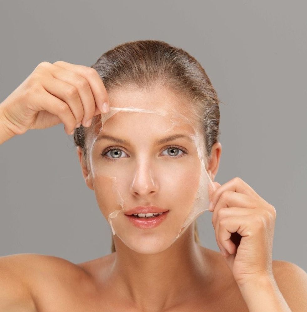 chemical peeling main e1449152897889