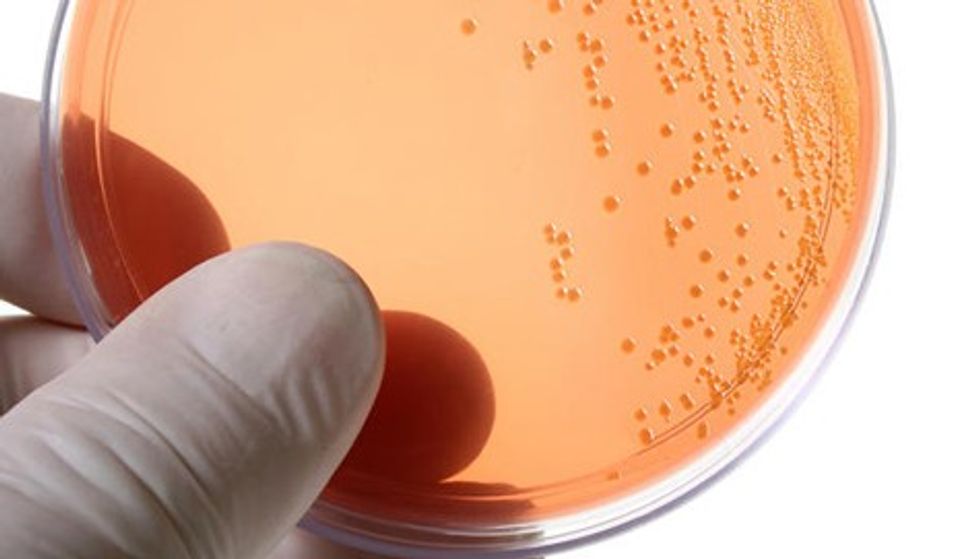 Chlamydia trachomatis culture