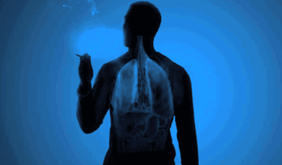 cigarettes are eating you alive