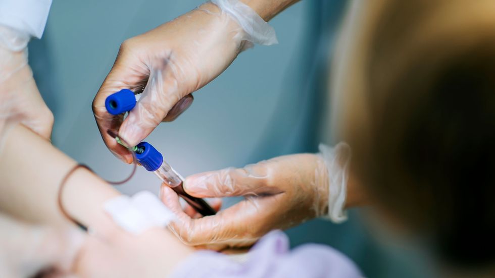 close up blood test 1303315827