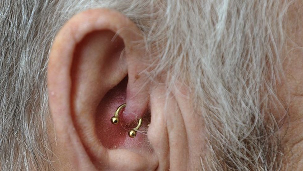 Colin Seaman, 70 who has been cured of migraines after having an ear ring. See Masons copy MNMIGRAINE: A pensioner who suffered 50 years of migraines claims to have been miraculously cured - by an EARRING. Colin Seaman, 70, had tried everything from strong drugs to clipping clothes pegs to his face to stop the excruciating pain caused by migraines. Father of two Mr Seaman began to suffer from migraines when he was 20, which would knock him for six. He had numerous treatments from doctors to try and take away the pain including injections around his eyes.