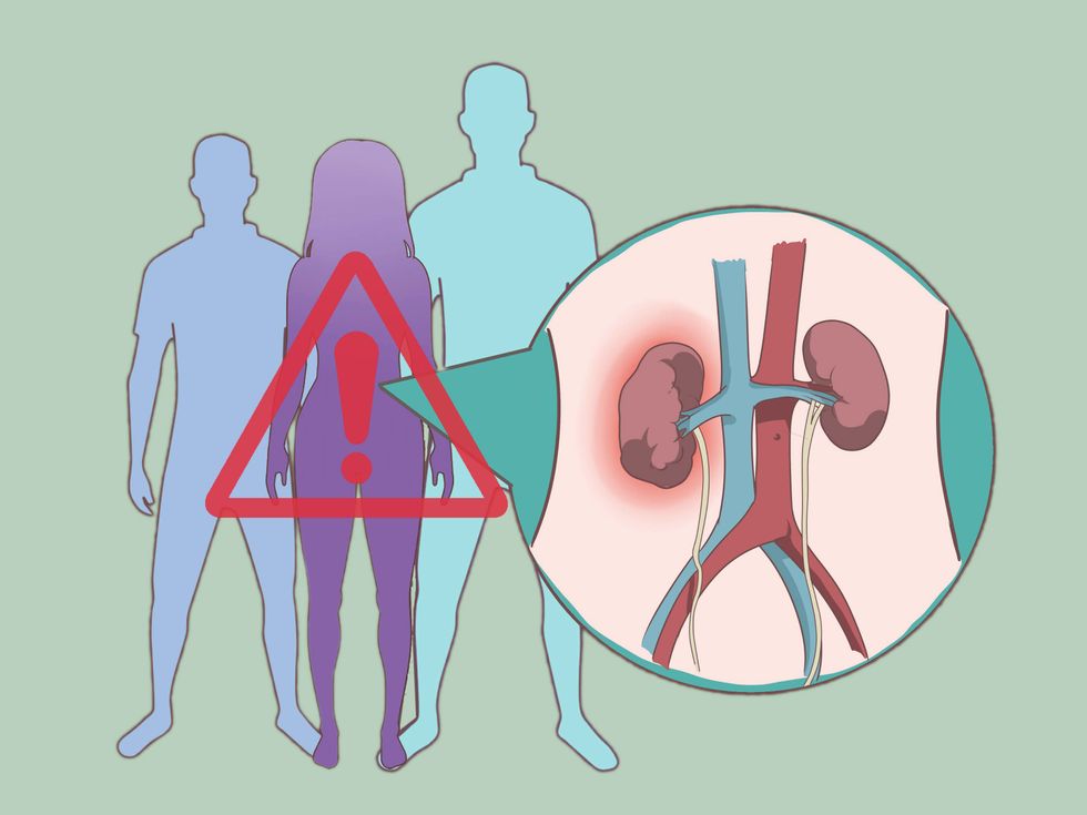 Control the Risk of Kidney Stone in Women Step 14