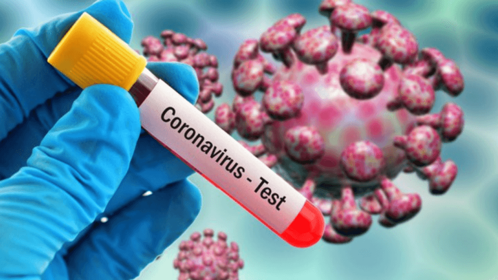 coronavirus test 1