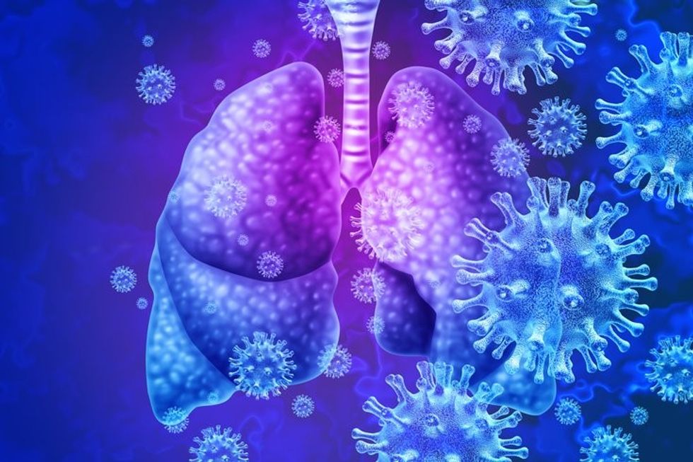 COVID 19 Pneumonia Lungs.9d204f46.fill 1
