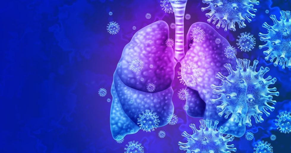 COVID 19 Pneumonia Lungs.9d204f46.fill c0
