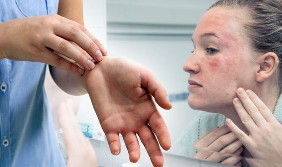 cream treatment rash symptoms 989554