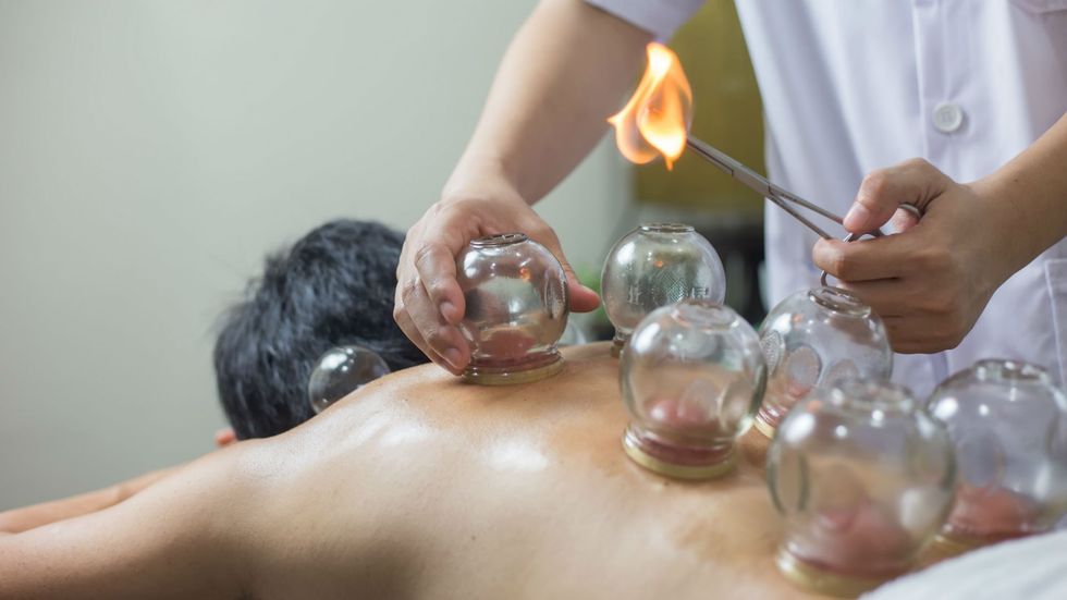 cupping tcm china chinese medicine pain ba gua