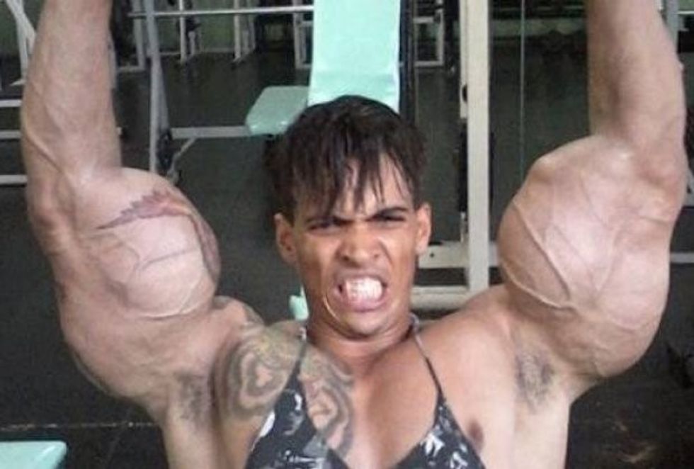 d1