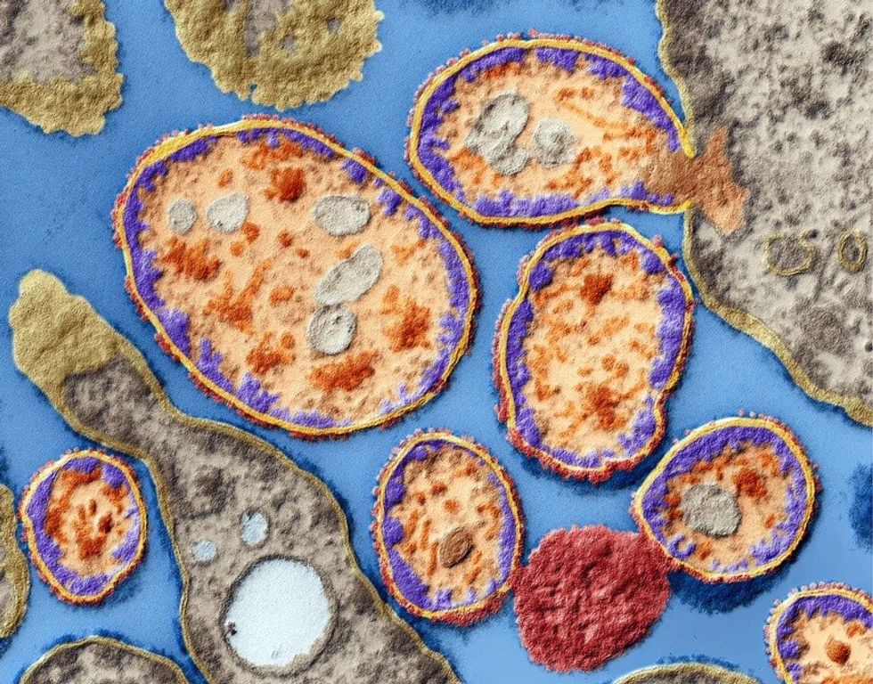 d41586 024 03647 0 27713234