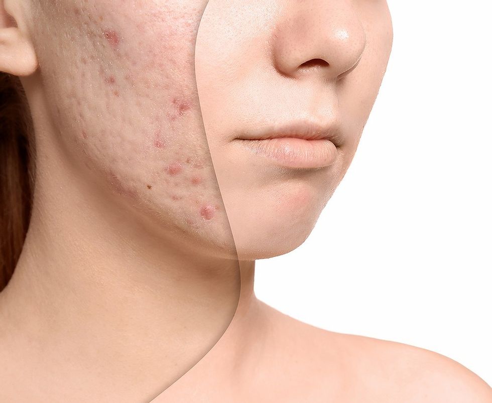 d449e3 8d0d5f233af64c83b9b8b6dfae81daff mv2