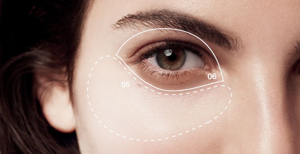 dark circles hyperpigmentation under eyes article