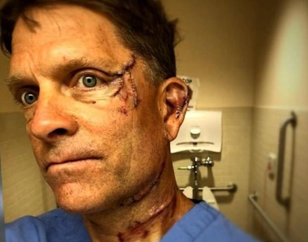 Dave Chernosky, 54, came face-to-face with a bear which struck him in the head and neck