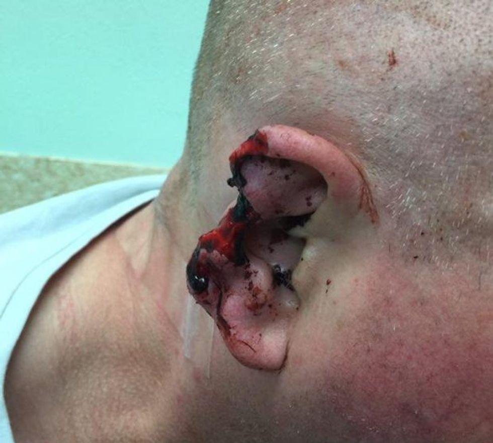 Debati për një sportit bëhet i dhunshëm sulmoi njerkun dhe ia kafshoi veshin foto 2