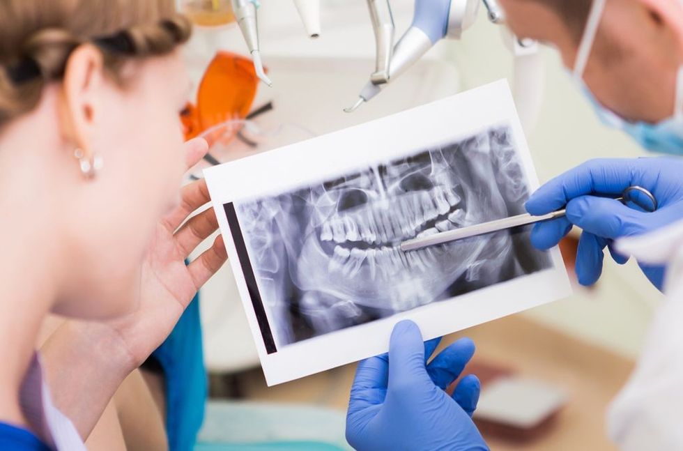 dental xray 01 compressor