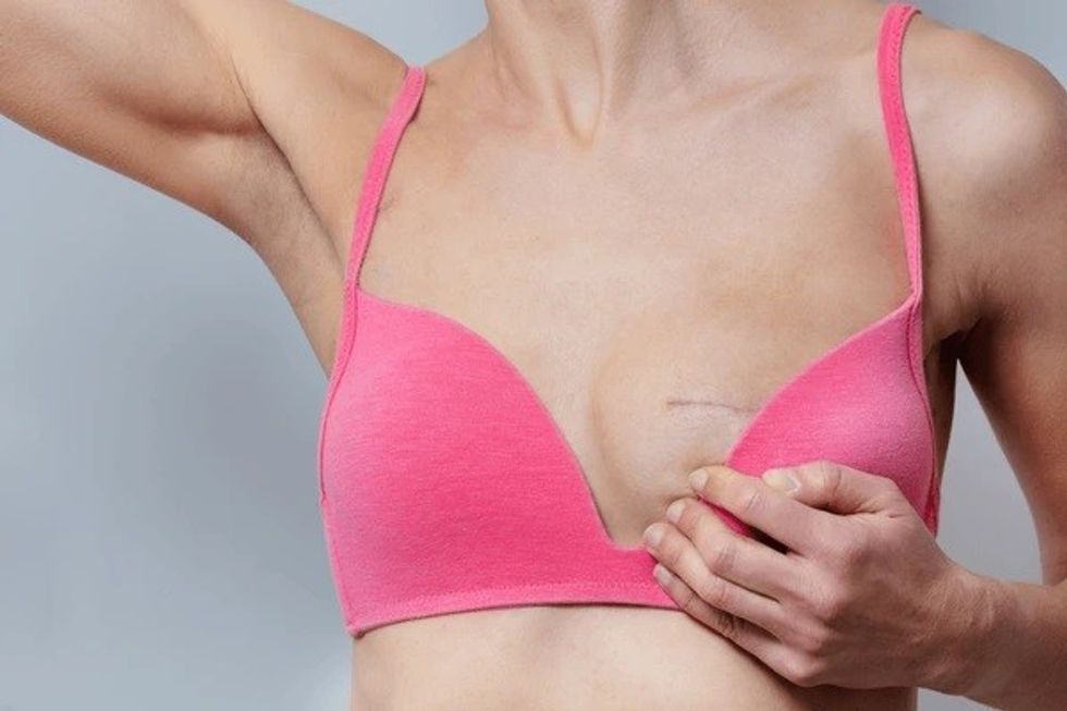 detailed view female scars breast 600nw 2469728453