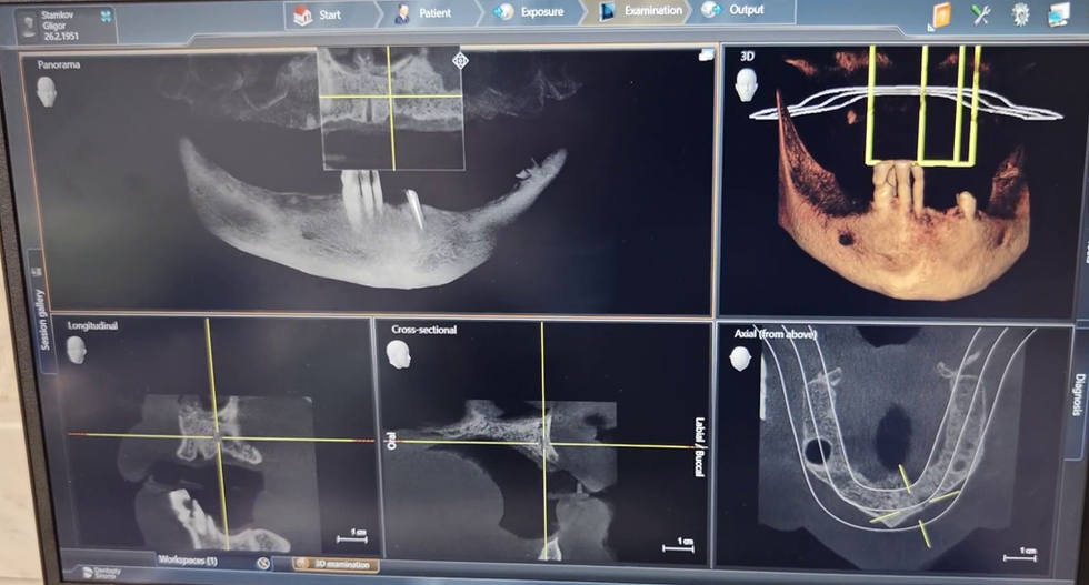 digitalna stomatologija slika