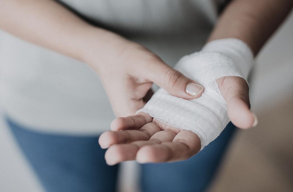 dipitrenova kontakcija slika 1