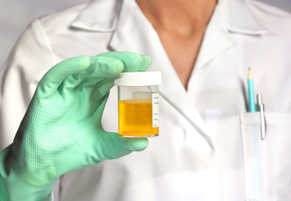 doctor with athlete sportsmans urine sample royalty free image 1581433416