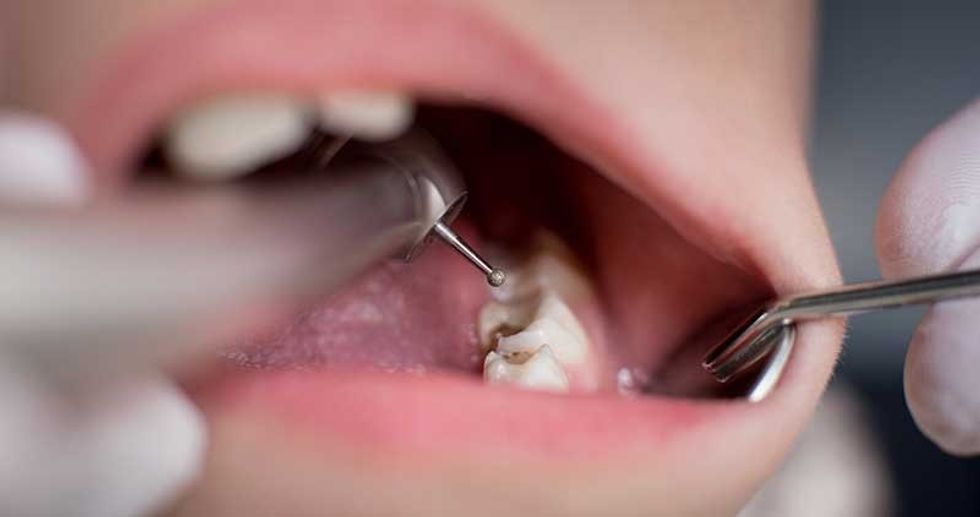 does tooth decay shorten ones lifespan