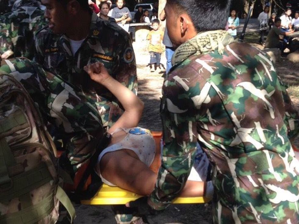 Donte të bënte selfie kafshohet keq nga krokodili foto 2