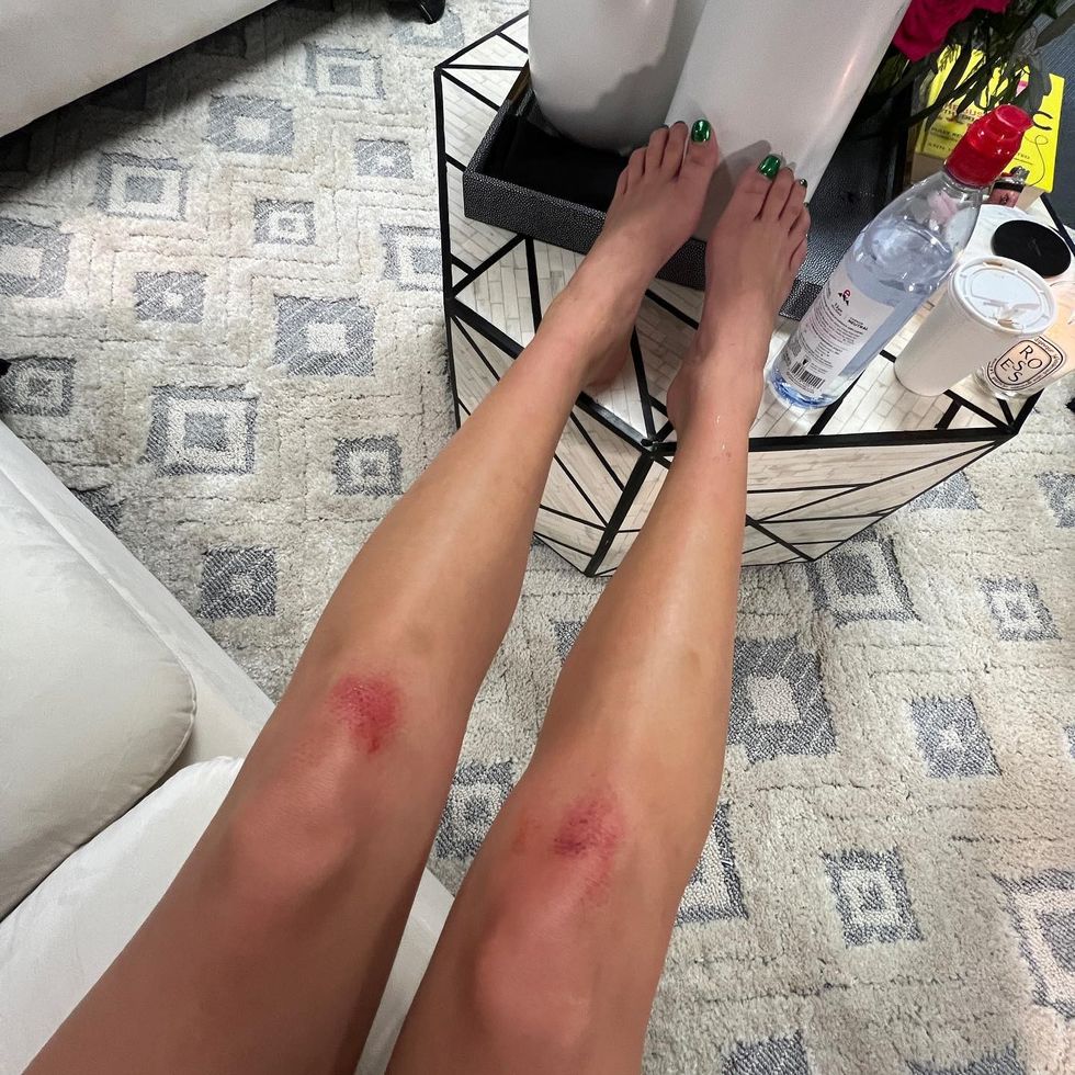 dualipa 274159329 251459243846311 7026064118560474721 n