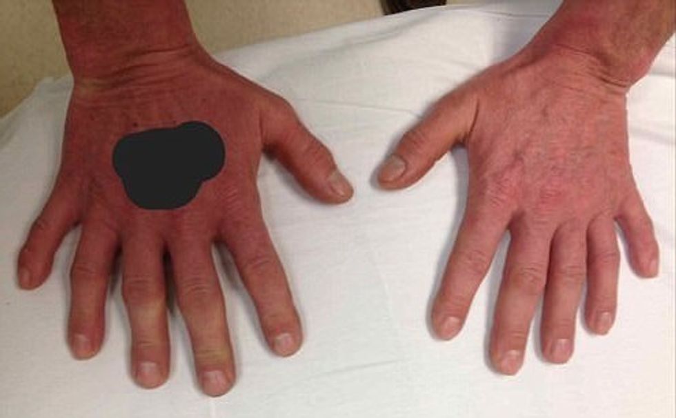 Duart e veçanta me nga një gisht shtesë qe levize njejte si te tjeret foto 2